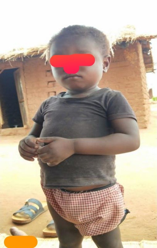 Do risco à esperança: a história de Miguel António* sobre como superar as adversidades